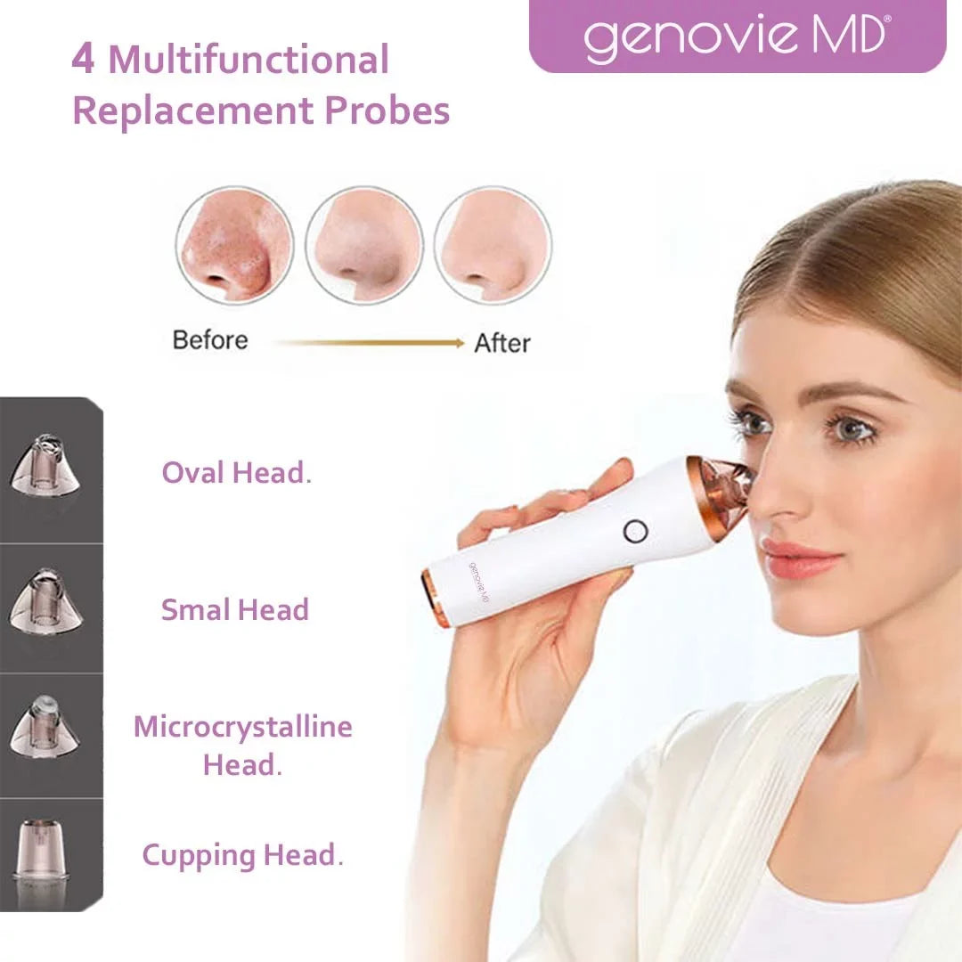 Genovie MD Acne and Deep Pore Cleansing Kit for Face, Acne Remover, Blackhead Remover, Facial Skin Treatment, Vacuum Suction